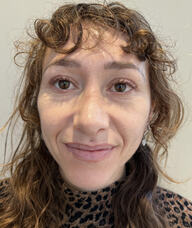 Book an Appointment with Lina Konovalov for Acupuncture